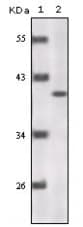 IHC-plus™ p16INK4a / CDKN2A Antibody (clone 5A8A4,3G8D12)