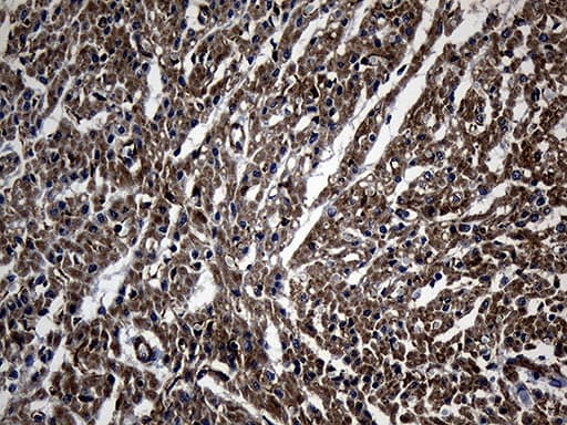 Monoclonal Mouse anti-Human NES / Nestin Antibody (clone OTI3B12, Carrier-free, aa99-349, IHC, WB)