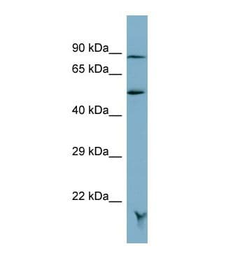 Polyclonal Rabbit anti-Human MRAP Antibody (N-Terminus, WB)