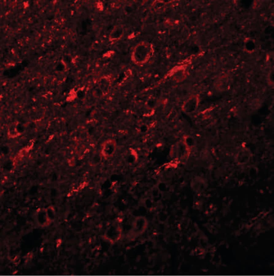 IHC-plus™ SYNGR2 / Synaptogyrin 2 Antibody