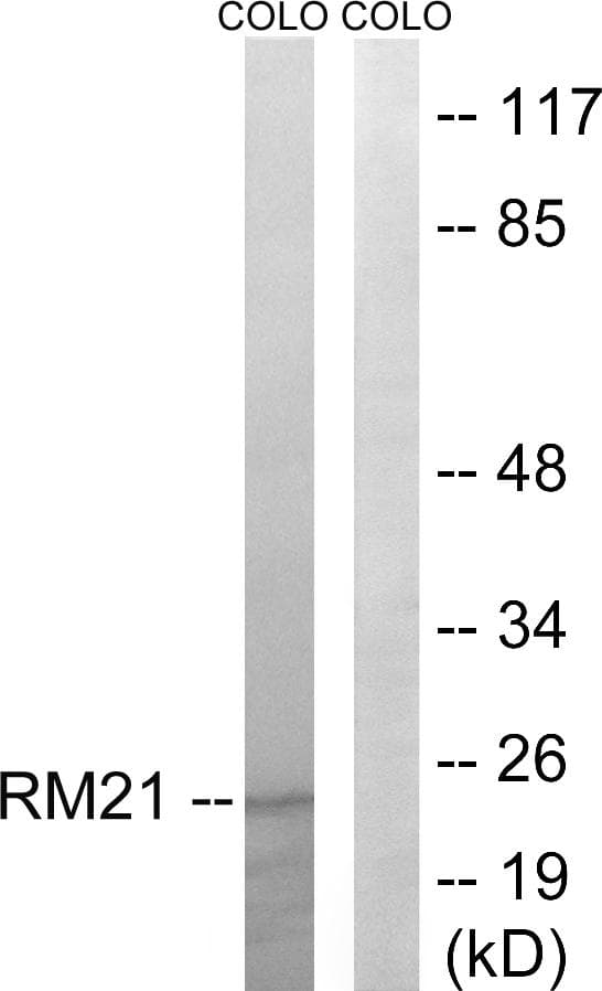 MRPL21 Antibody