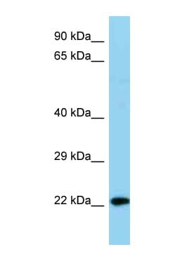 NDUFB8 Antibody (C-Terminus)