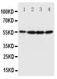 FSCN1 / Fascin Antibody (aa97-113)