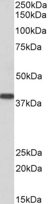 IHC-plus™ SET / TAF-I Antibody (aa2-15)