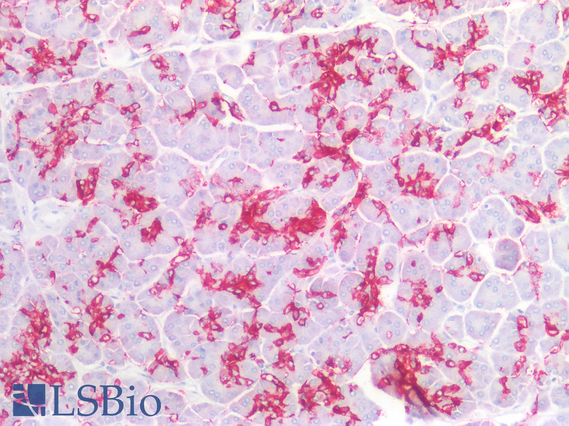 PathPlus™ Sialylated Lewis a / CA 19-9 Antibody (clone 121SLE)