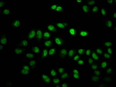 HIST1H2BN Antibody