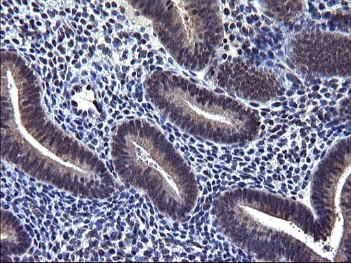 TXNDC5 / ERP46 Antibody (clone OTI2E6)