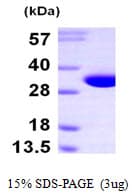 Human NIT2 Protein (Recombinant His)