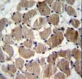Cochlin / COCH Antibody (aa399-428)