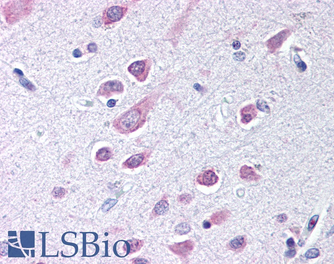 PathPlus™ SEMA3B / SemA Antibody (aa100-200)