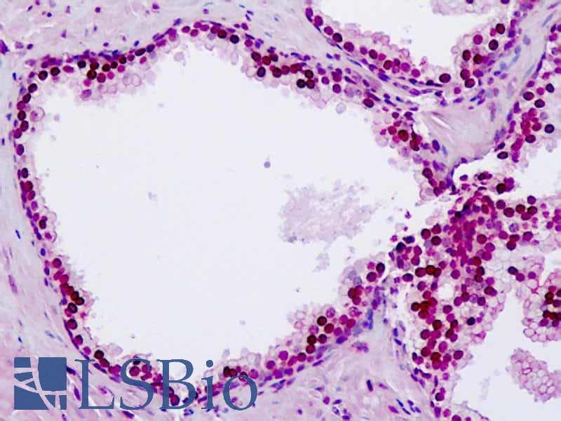 IHC-plus™ CDKL1 Antibody (aa281-330)