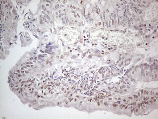 MMP2 Antibody (aa228-507, clone OTI4A11)