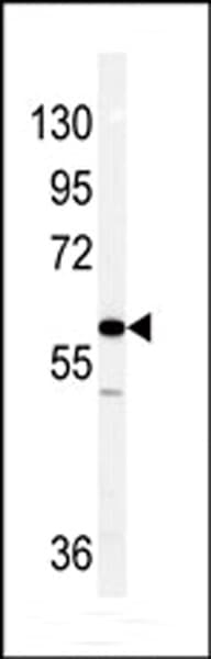 Polyclonal Rabbit anti-Human Vimentin Antibody (aa430-457, IHC, IF, WB)