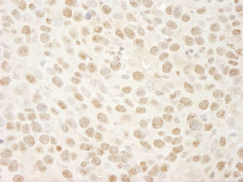 Polyclonal Rabbit anti-Human SMARCA4 / BRG1 Antibody (aa75-125, IHC)
