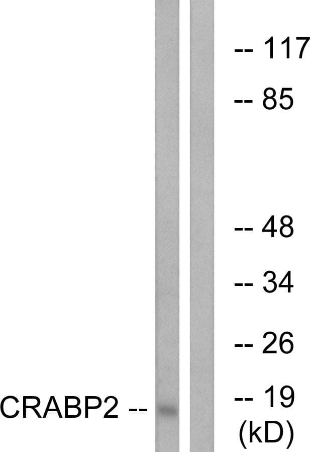 CRABP2 Antibody