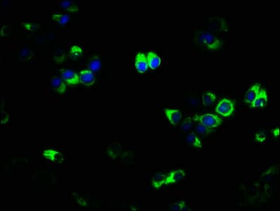 IHC-plus™ TNFRSF11A / RANK Antibody