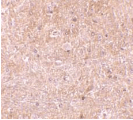 Polyclonal Rabbit anti-Human CASP13 / Caspase 13 Antibody (IHC, WB)
