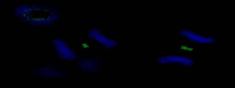 Polyclonal Rabbit anti-Human PLK1 / PLK-1 Antibody (aa325-375, IF)