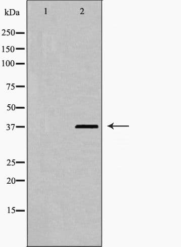 HNRNPD / AUF1 Antibody (phospho-Ser83)