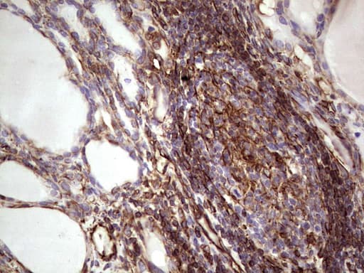 Peripherin Antibody (clone OTI1E10)