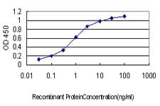 PathPlus™ CDH17 / Cadherin 17 Antibody (clone 1H3)