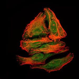 Monoclonal Mouse anti-Human BPIFA2 / SPLUNC2 Antibody (clone 1F12, IHC, WB)