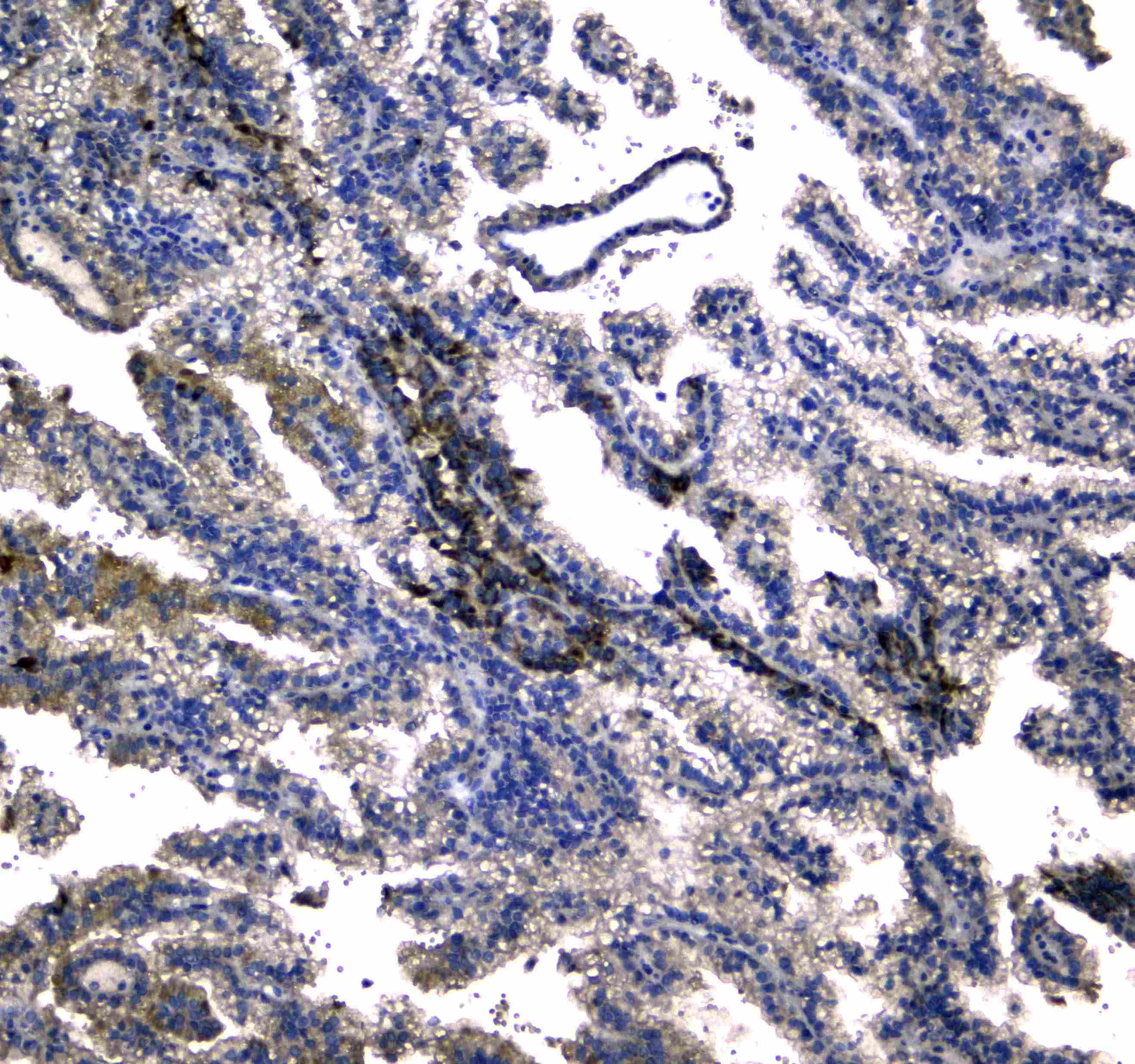 NOX4 Antibody