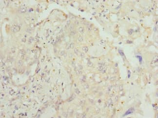 Polyclonal Rabbit anti-Human LECT1 / Chondromodulin-I Antibody (IHC)