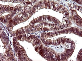 SERPINB3 Antibody (clone OTI1A12)