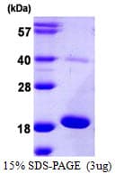 Human AG3 / AGR3 Protein (Recombinant His)