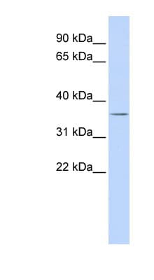 VSX1 Antibody (aa288-337)