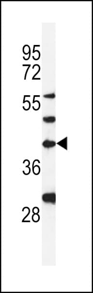 DPAGT2 / DPAGT1 Antibody (aa286-315)