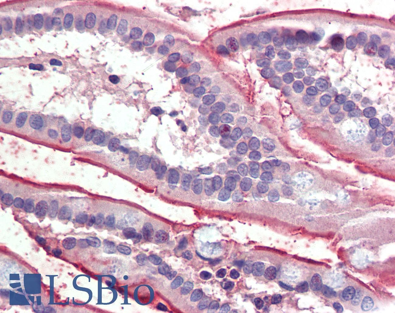 IHC-plus™ SLC5A1 / SGLT1 Antibody (aa458-472)