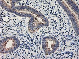 Monoclonal Mouse anti-Human MTFMT Antibody (clone OTI1E7, aa175-389, IHC, WB)