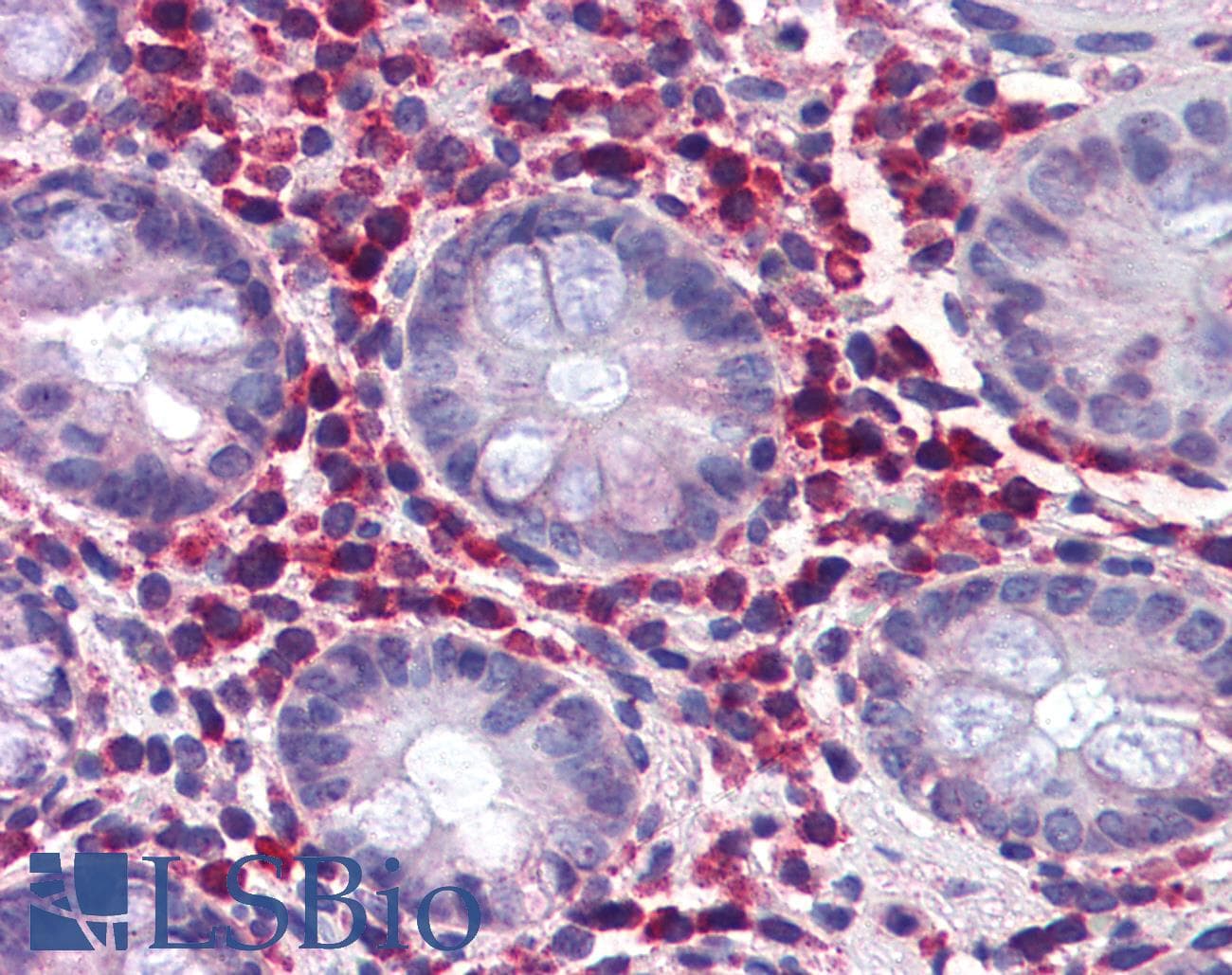 IHC-plus™ Polyclonal Goat anti-Human TRIM21 / RO52 Antibody (aa463-475, IHC, IF, WB)