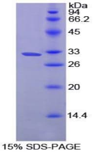 Rat PRCP Protein (Recombinant His-T7)