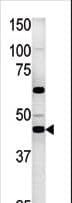 Polyclonal Rabbit anti-Human PGK2 Antibody (aa305-333, WB)