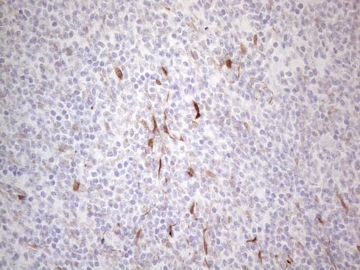 Monoclonal Mouse anti-Human CSF2 / GM-CSF Antibody (clone OTI8G5, aa18-144, IHC, WB)