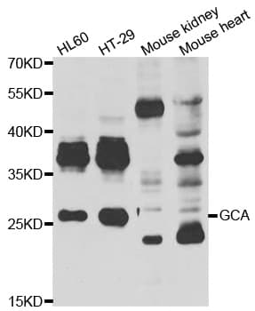 GCL / Grancalcin Antibody