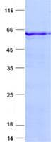 Human ZNF434 Protein (Recombinant His, N-Terminal)