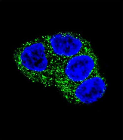 UGT1A / UGT1A1 Antibody (aa65-90)
