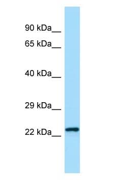 CHMP2B Antibody (N-Terminus)