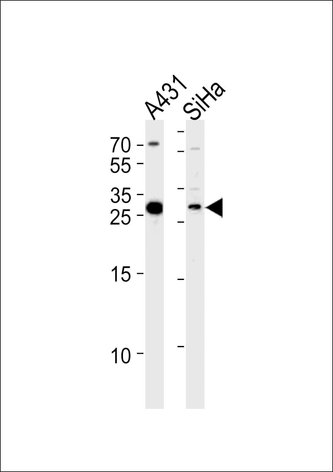 Polyclonal Rabbit anti-Human HSD17B12 Antibody (aa126-155, IHC, WB)