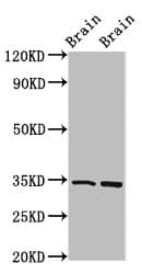 FOXE3 Antibody
