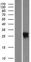 YIPF6 Protein (Over-Expression Lysate Myc-DDK (Flag))