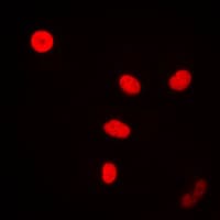 FEN1 Antibody (Internal)