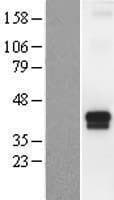 TMPRSS4 Protein (Over-Expression Lysate Myc-DDK (Flag))