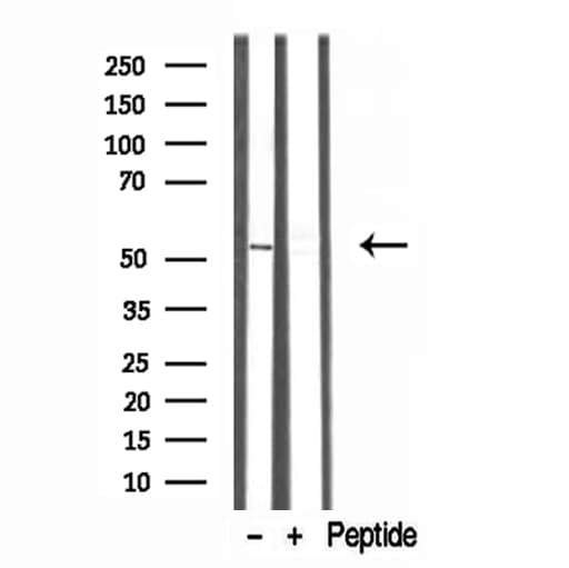 TRIM44 Antibody