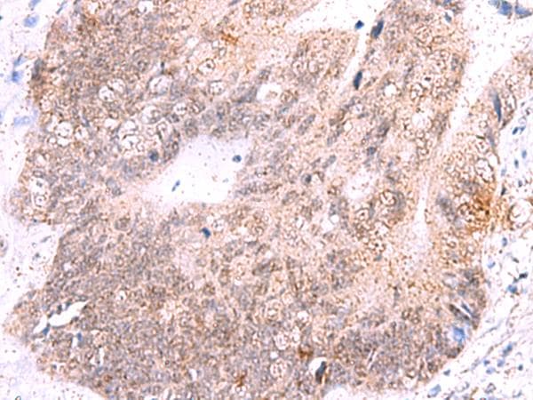ASTN2 Antibody (aa1120-1339)