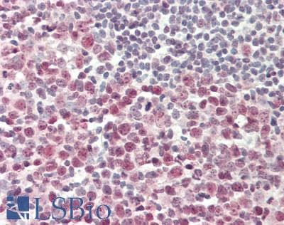 IHC-plus™ Polyclonal Rabbit anti-Human POLR3G Antibody (Internal, IHC, WB)